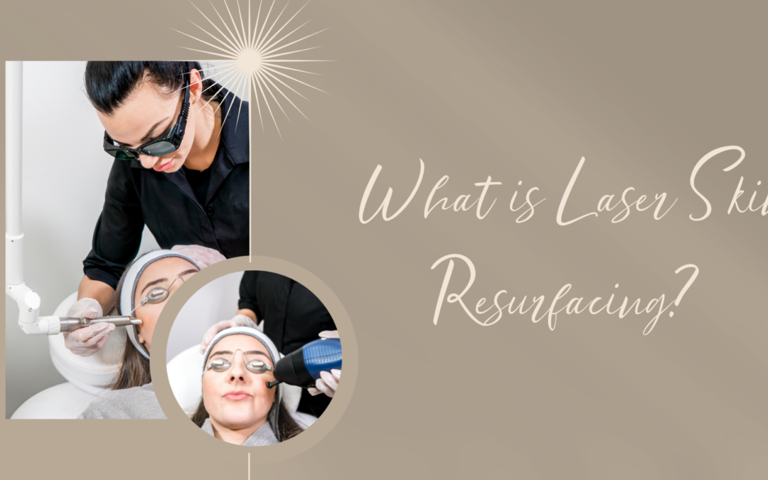 What Is Laser Skin Resurfacing?