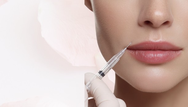 Juvederm lip filler